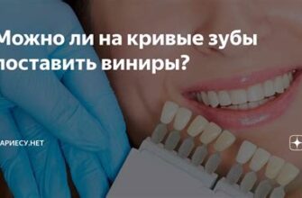 Можно ли поставить виниры бесплатно