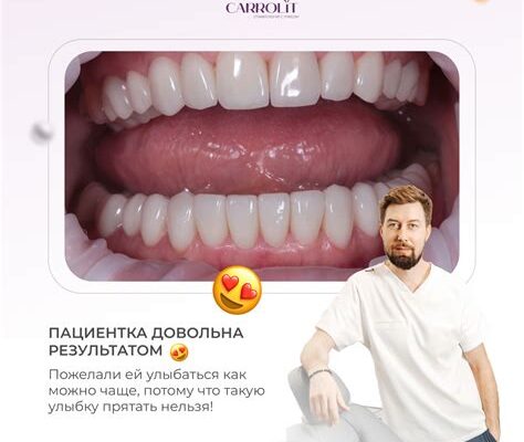 Врач ставит коронки и виниры