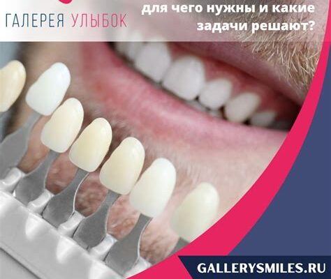 Виниры их назначение